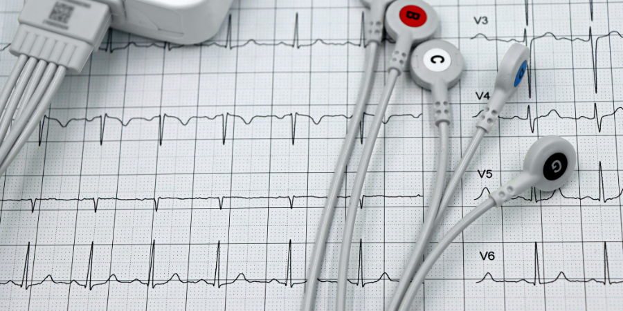 ECG & Basic Diagnostics